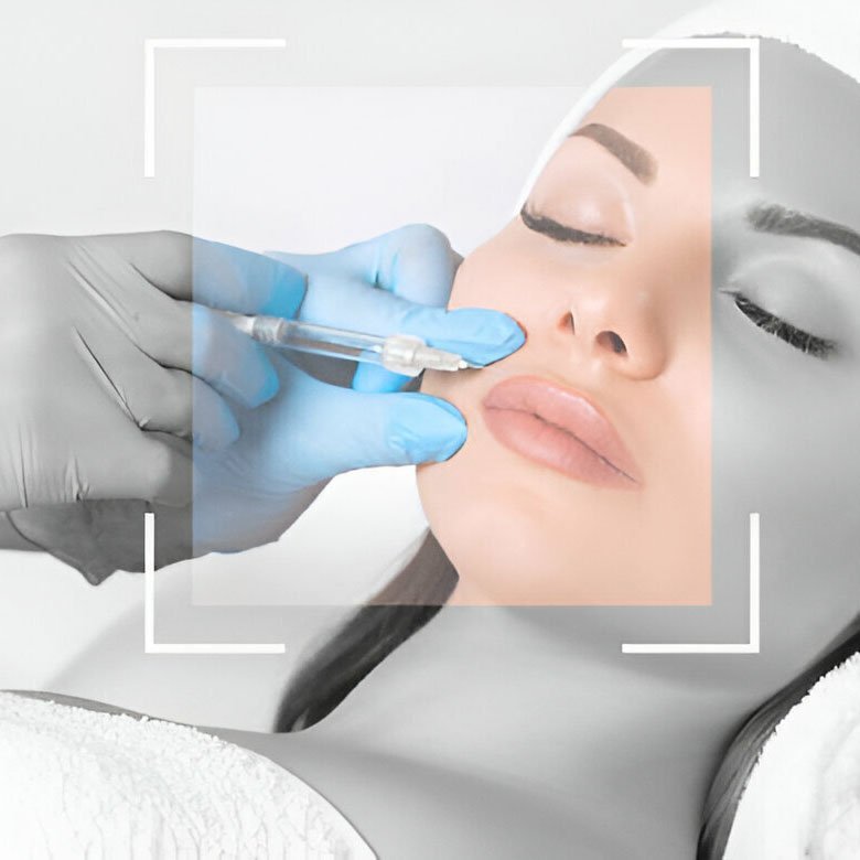 Dermal fillers for lips cheeks and chin